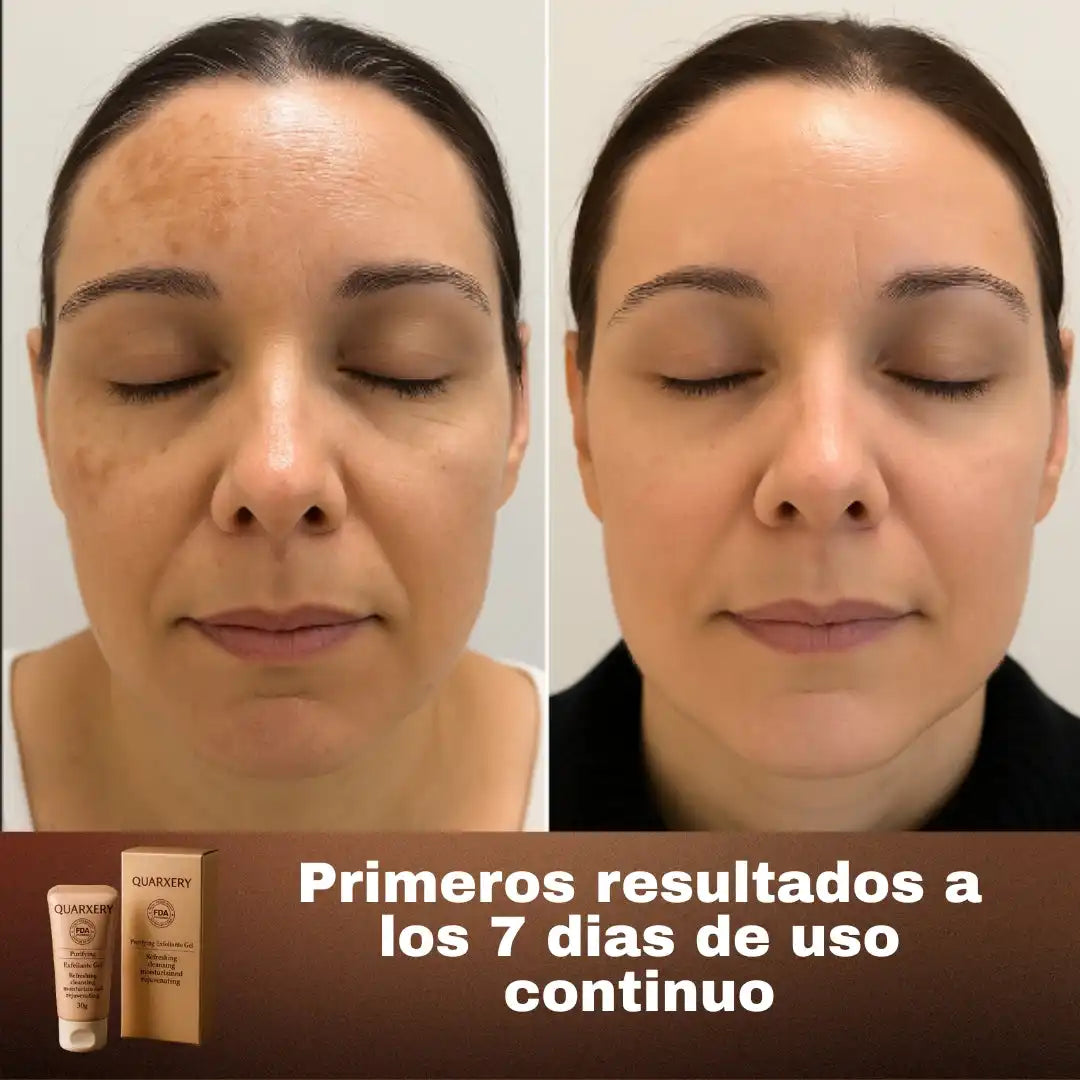 QUARXERY™️🌿 Gel Anti Manchas 2x1 IMPORTADO us