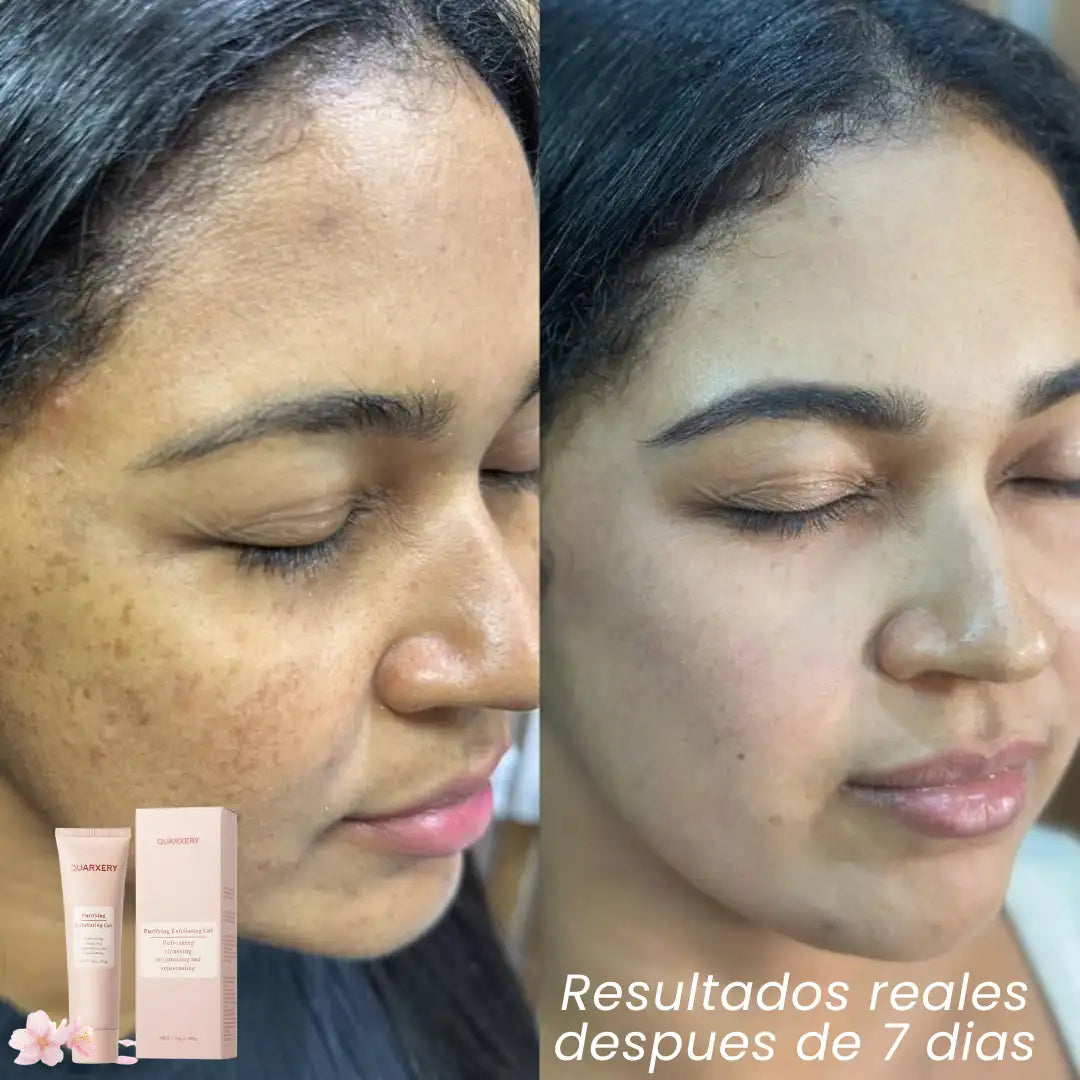 QUARXERY™️🌿 Gel Anti Manchas 2x1 IMPORTADO us