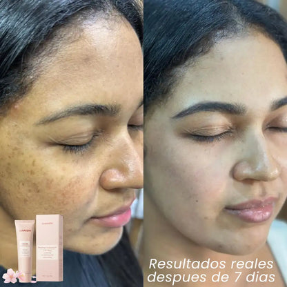 QUARXERY™️🌿 Gel Anti Manchas 2x1 IMPORTADO us